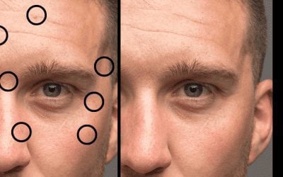 How to find and remove blemishes in Photoshop